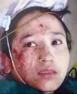 昆明301恐怖事件女暴徒已清醒并招供动机和过程